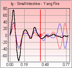 Pulse wave - Small Intestine position